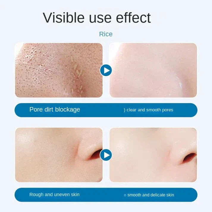 Oligopeptide Small Bubble Cleansing Essence(10 Pcs)